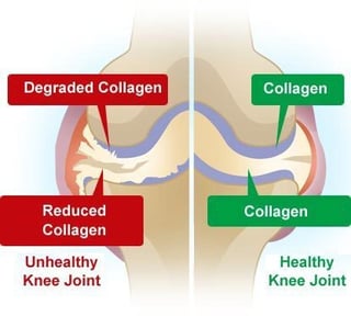joint-pain-supplements-collagen-1.jpg